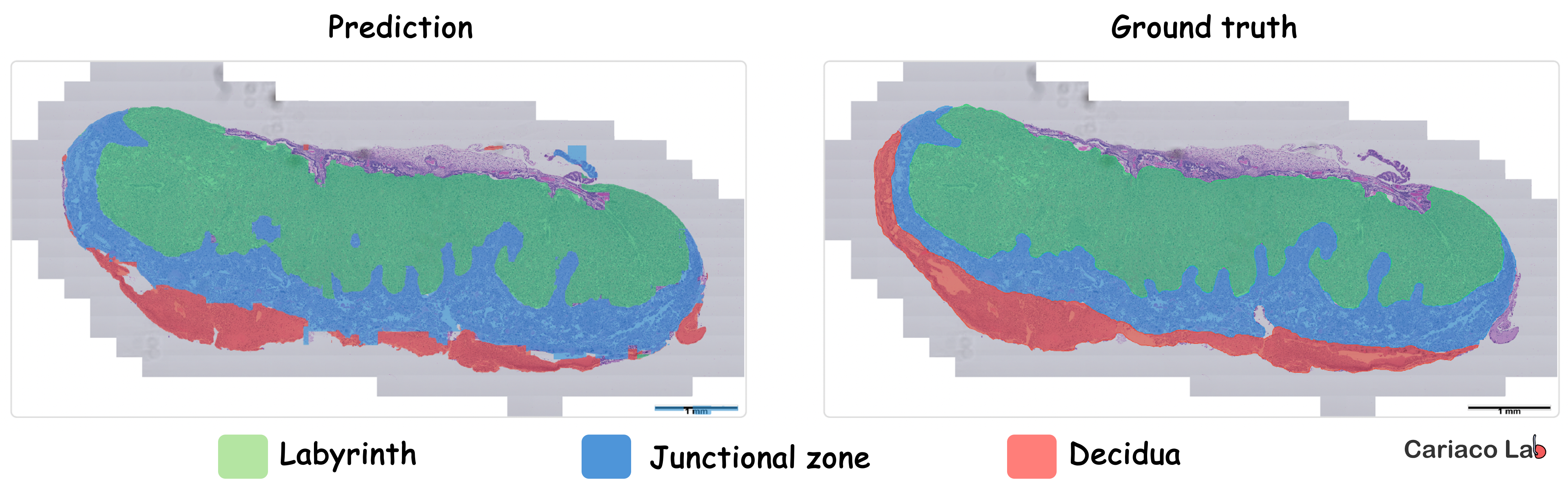 Tissue microstructure quantification